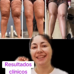 BYE BYE CELULITIS